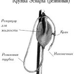 Кружка эсмарха