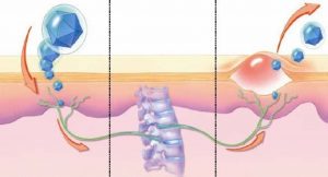 Herpes causes osteoporosis and aseptic necrosis