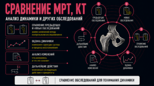 сравнение и динамика МРТ при асептическом некрозе, АНГБК
