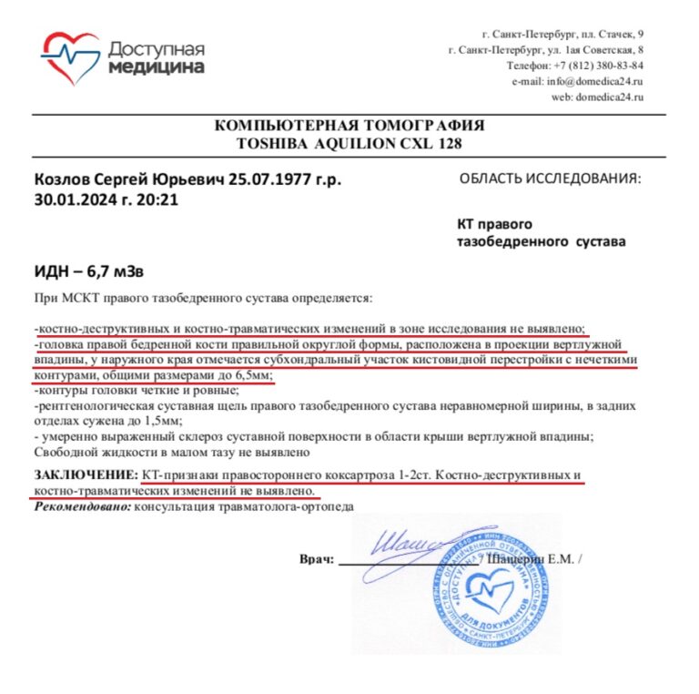 КТ правый ТБС