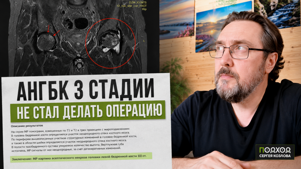 Результаты и истории лечения пациентов АНГБК